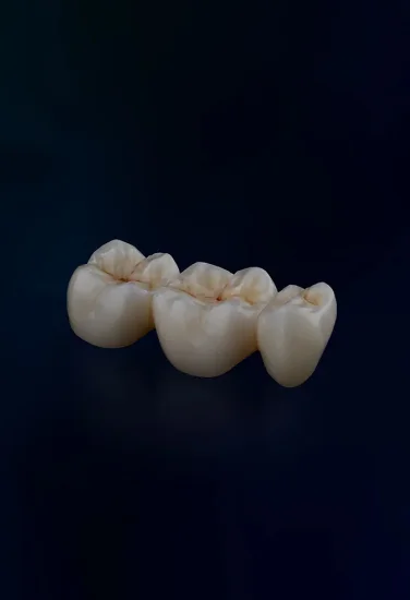 Definitive veneers and crowns prepared digitally using prosthetic