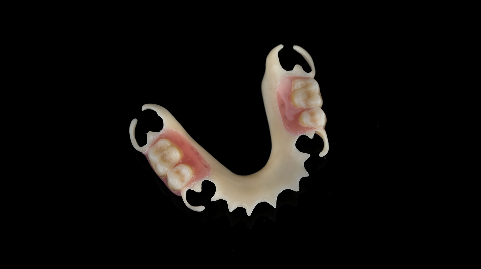 flexible denture